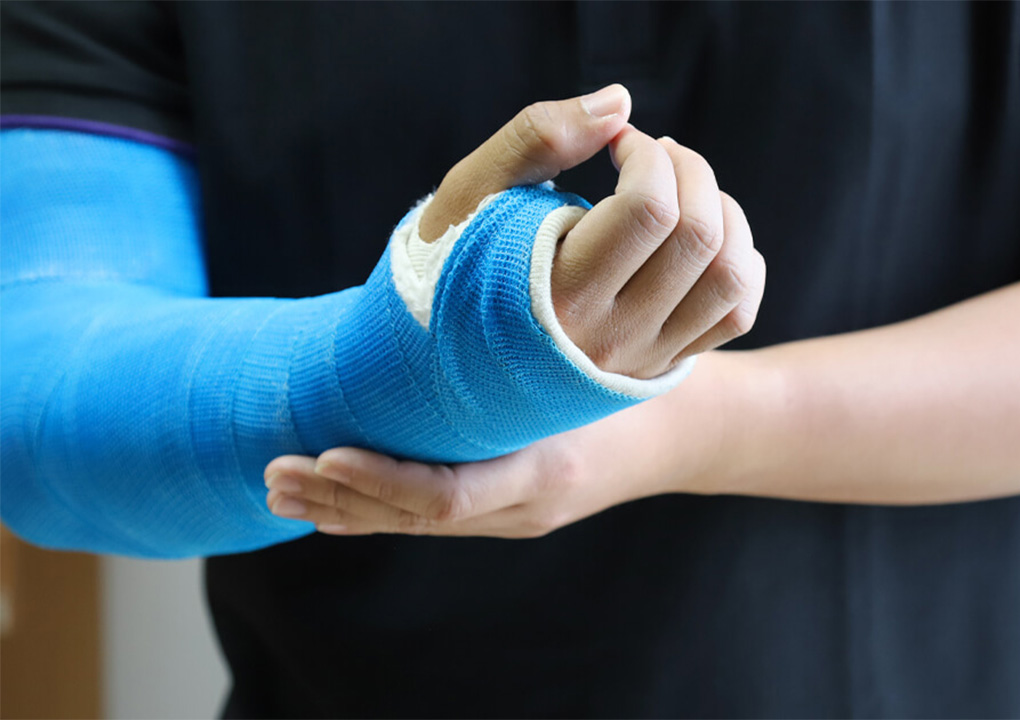 Complications Wrist Cast