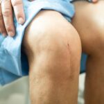 knee replacement surgery - liberty orthopaedic