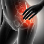 Hip Dysplasia