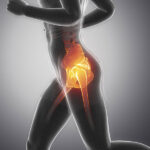 Osteoarthritis of the Hip