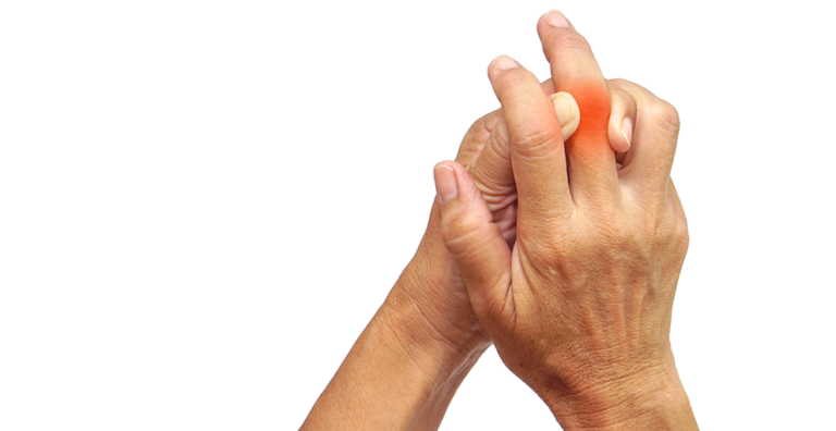 Two hands clasping a finger that is reddened, suggesting finger pain or injury